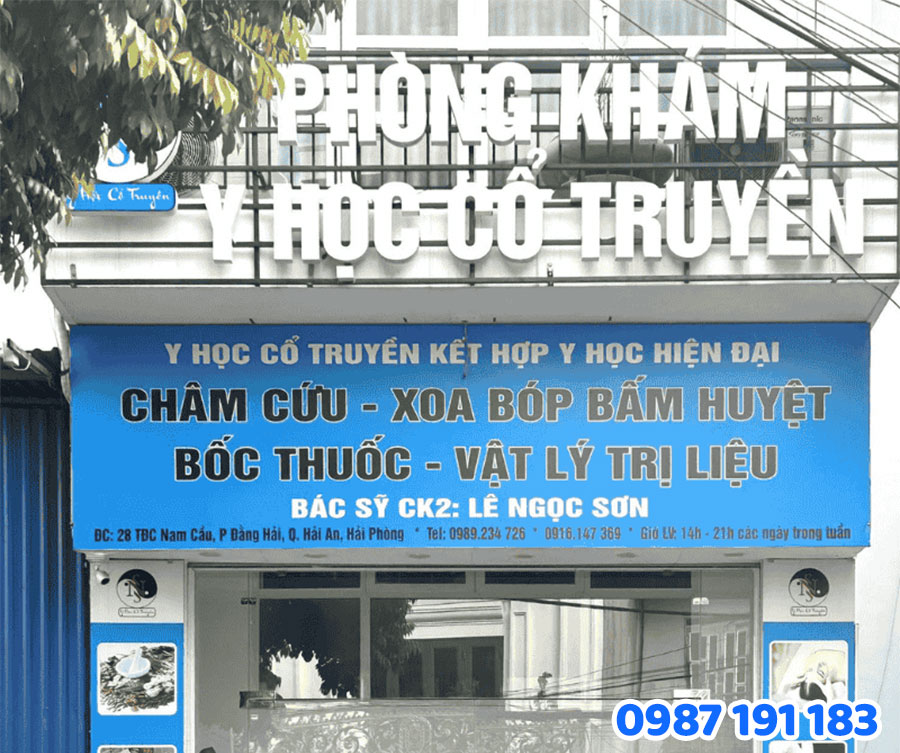 Lưu ý về kích thước và vị trí lắp đặt